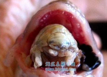 恐怖寄生虫视频大全_恐怖寄生虫游戏下载手机版_恐怖恶心寄生虫